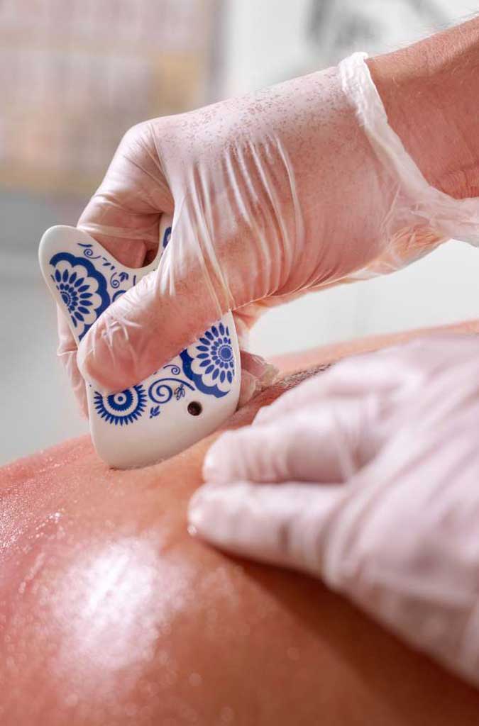 Symbolbild Gua Sha-Behandlung mit Raphael Vergères als Therapeut